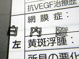 糖尿病→痛風発作→脇腹痙攣ときて白内障…これで最後？