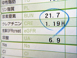 摂った糖質量以上に上がらない血糖値と違い尿酸値は面倒だ