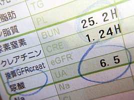 猛暑の釣行で尿酸値が跳ね上がったようで痛風発作の予兆が