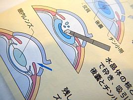 最近起きている悪循環。視力低下→仕事遅い→釣り行けない