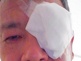 【番外編】2泊3日で入院し両目の白内障の手術をしてきたよ